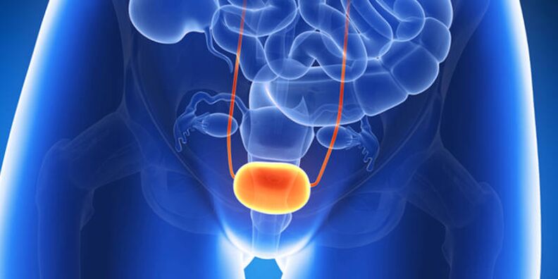 Bladder inflammation treatment with tablets